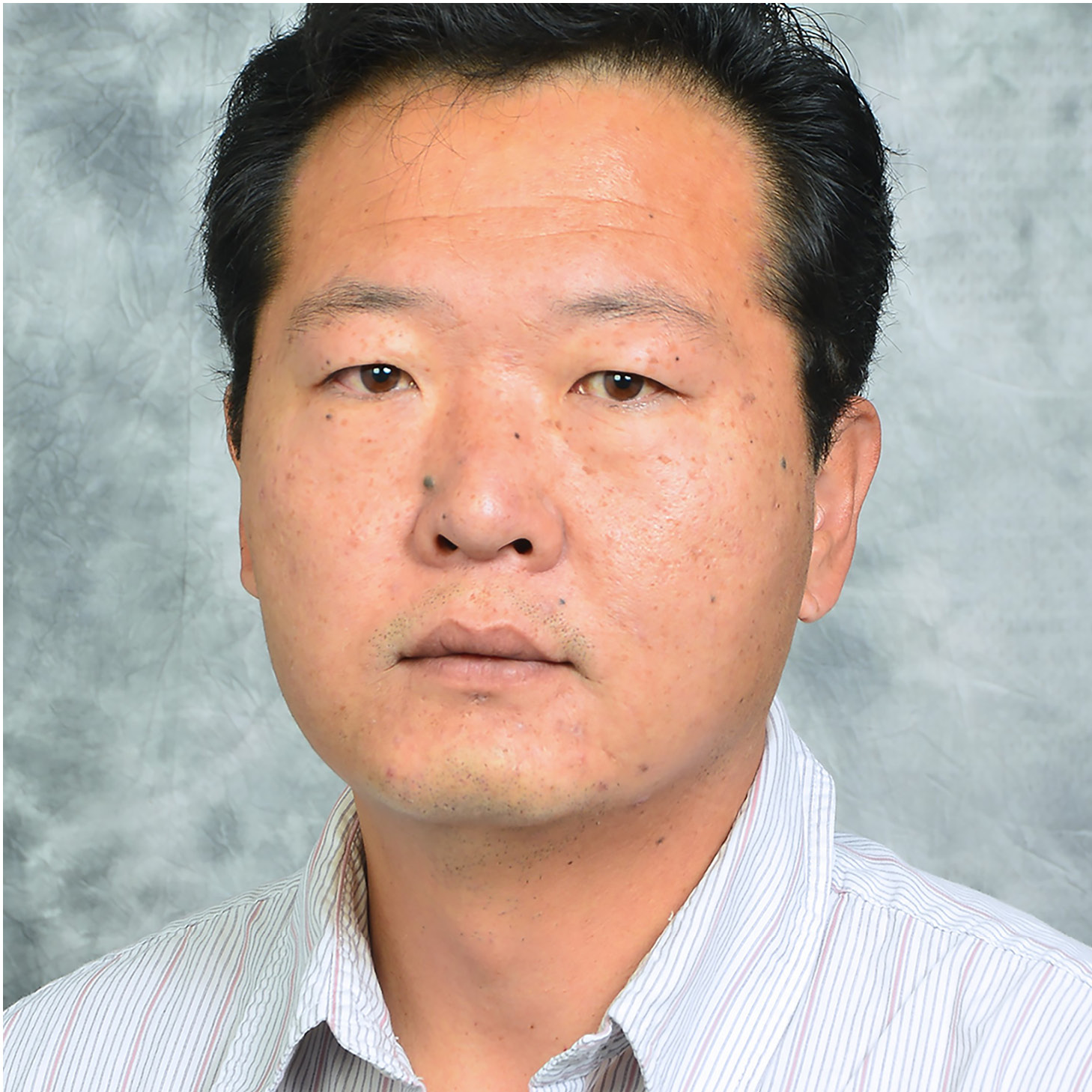 Xuesong Chen, MD, PhD